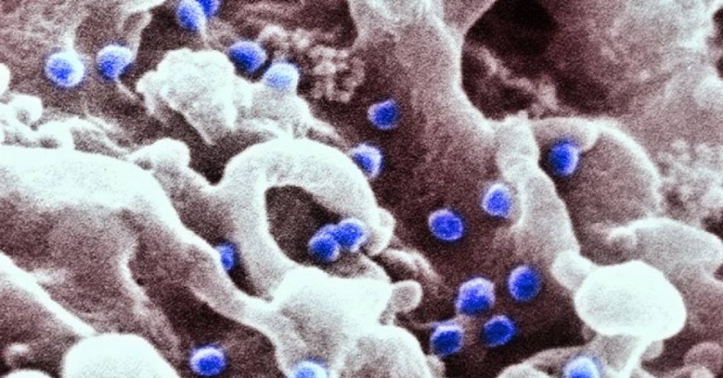 cura-do-hiv-segue-distante,-mas-descoberta-cientifica-renova-esperanca