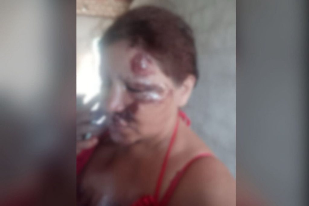 mulher-e-agredida-com-capacete-e-abandonada-na-rua-pelo-companheiro-apos-discussao