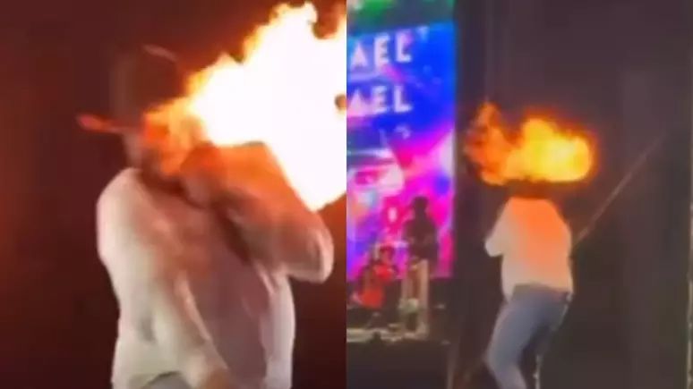 cantor-sertanejo-sofre-queimaduras-no-rosto-apos-ser-atingido-por-chamas-durante-show