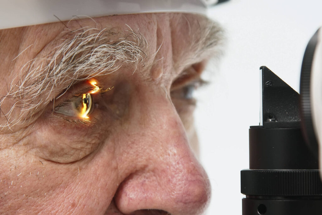 no-futuro,-alzheimer-podera-ser-diagnosticado-a-partir-de-exames-de-vista-de-rotina,-indica-estudo