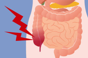para-que-serve-o-apendice?-biologos-explicam-a-evolucao-do-orgao