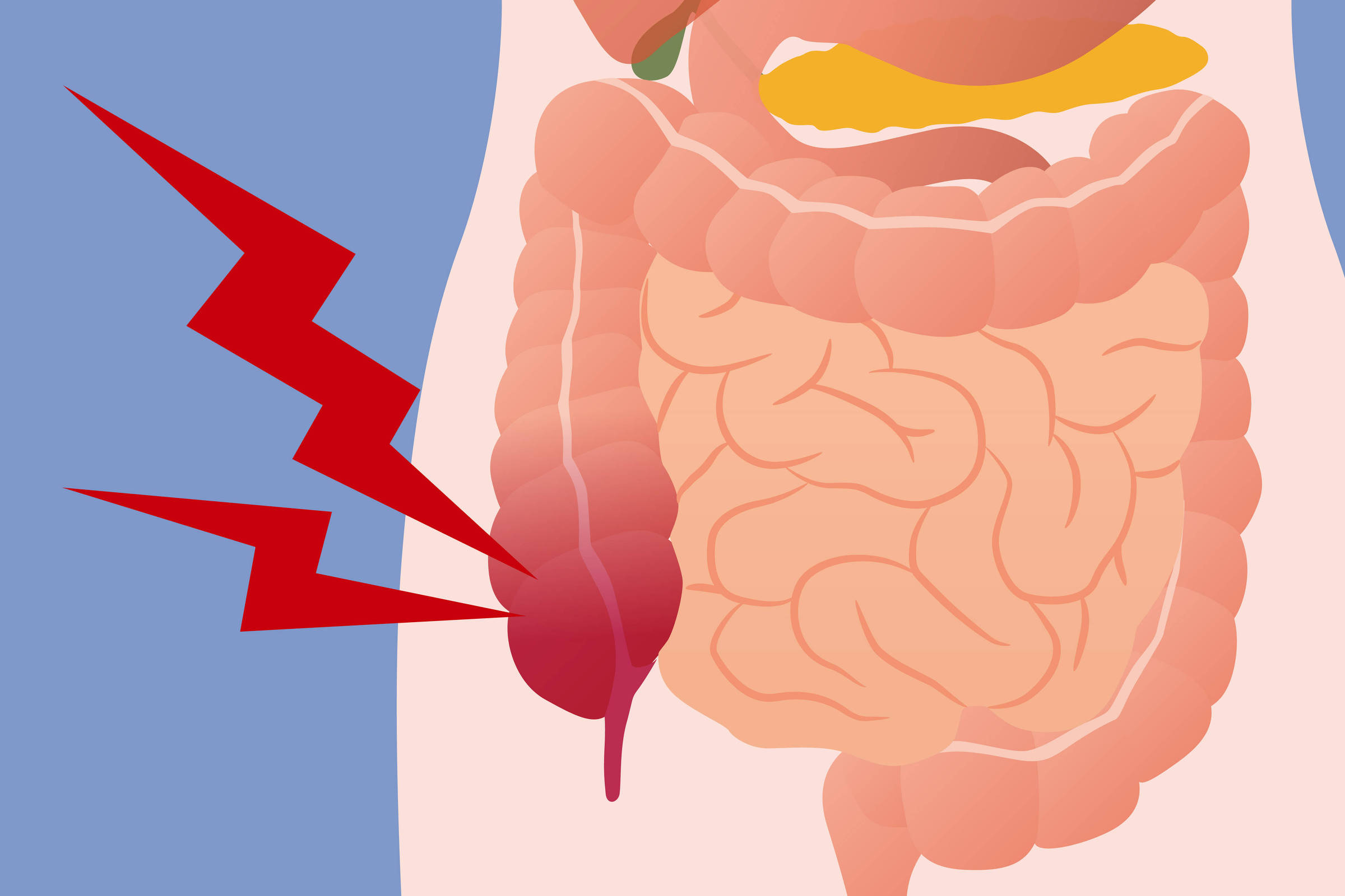 para-que-serve-o-apendice?-biologos-explicam-a-evolucao-do-orgao