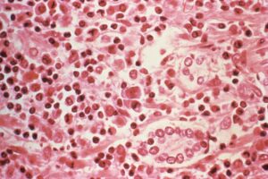 surtos-de-hantavirus-sao-raros,-mas-nao-vao-desaparecer-e-nao-ha-cura