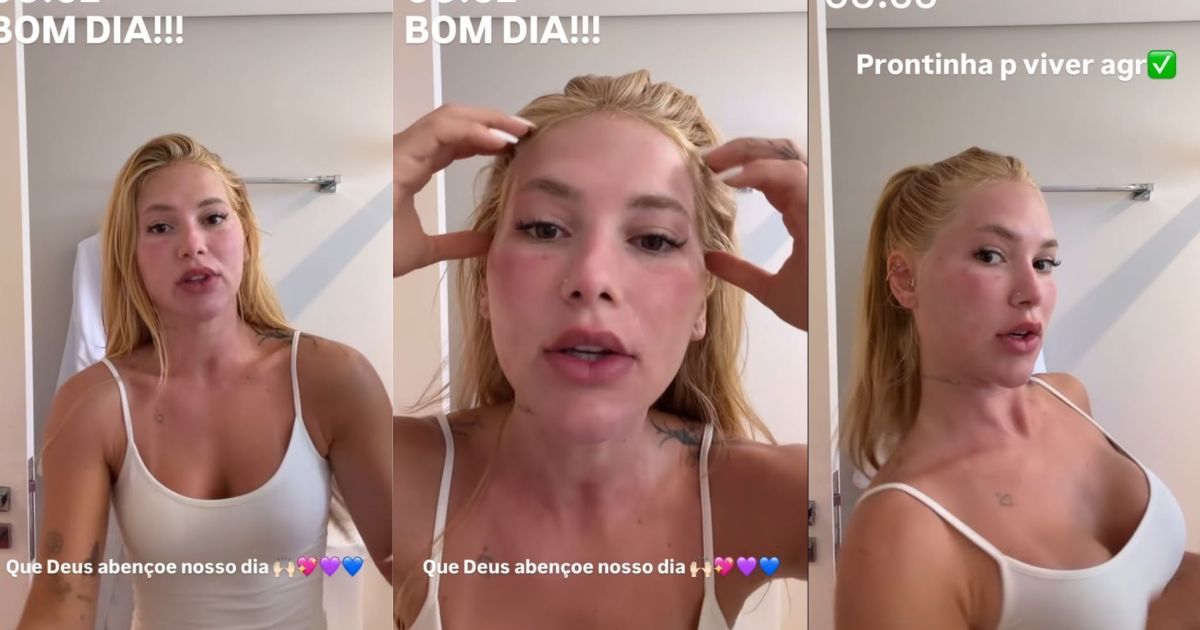 “reacoes-sao-esperadas”,-dizem-especialistas-apos-procedimento-de-virginia