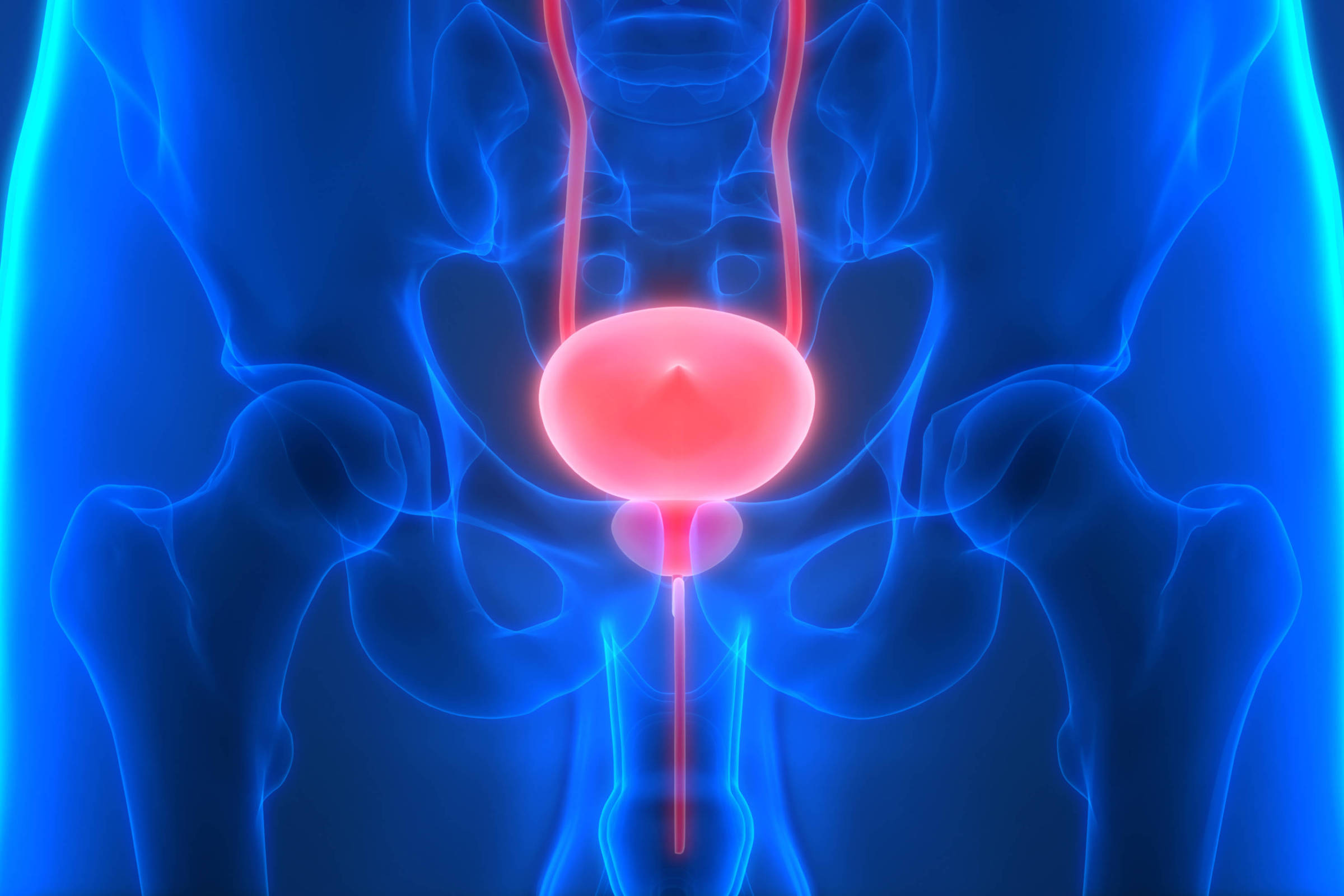 raro-e-agressivo,-cancer-de-bexiga-demanda-diagnostico-agil-e-precoce