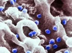 cura-do-hiv-segue-distante,-mas-descoberta-cientifica-renova-esperanca