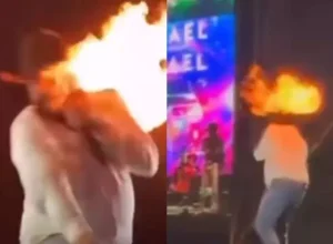 cantor-sertanejo-sofre-queimaduras-no-rosto-apos-ser-atingido-por-chamas-durante-show