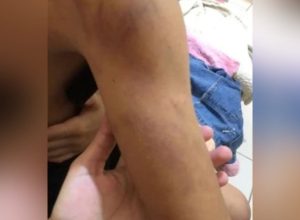 crianca-de-8-anos-e-espancada-pelo-proprio-pai-por-beber-achocolatado-sem-permissao