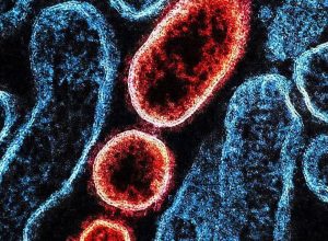 nipah:-o-virus-que-causa-preocupacao-na-asia-e-voltou-a-deixar-aeroportos-em-alerta-na-regiao