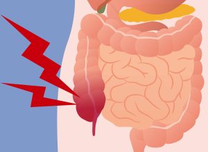 para-que-serve-o-apendice?-biologos-explicam-a-evolucao-do-orgao