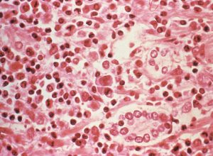 surtos-de-hantavirus-sao-raros,-mas-nao-vao-desaparecer-e-nao-ha-cura