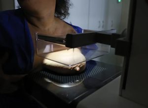 ans-defende-que-plano-cubra-mamografia-digital-sem-restricao-de-idade