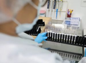 malaria:-anvisa-autoriza-teste-em-humanos-de-vacina-100%-brasileira